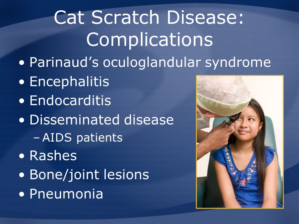 Cat Scratch Disease And Other Bartonella Infections - Ppt Video Online ...