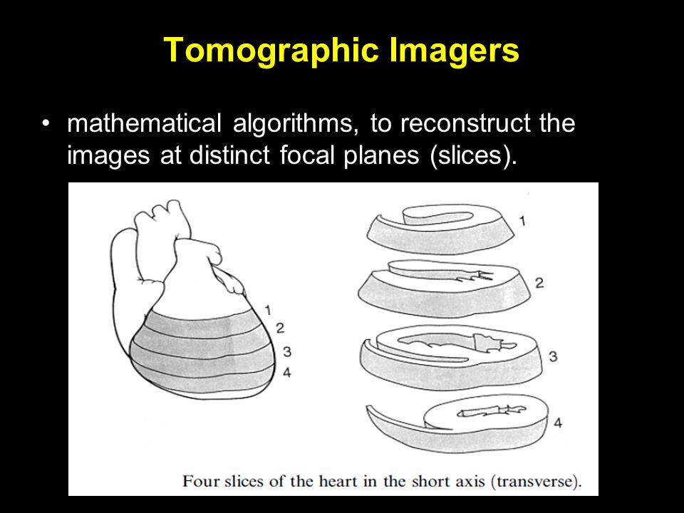 Tomographic Imagers mathematical algorithms, to reconstruct the images at distinct focal planes (slices).