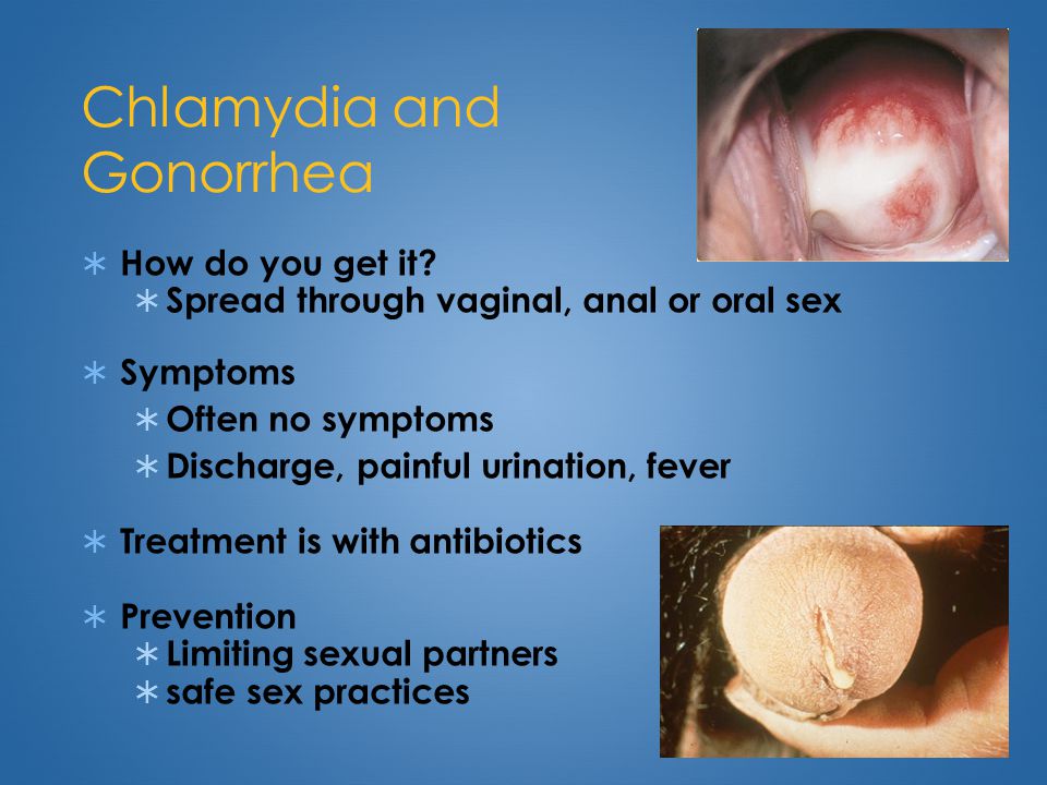 Diseases Passed By Oral Sex