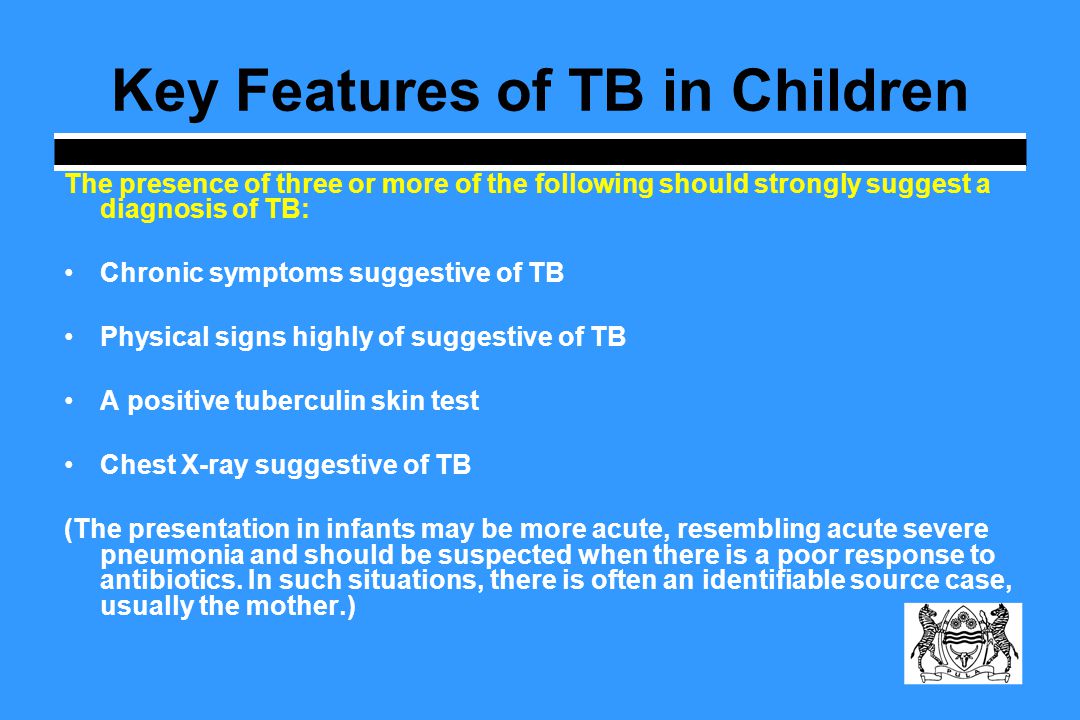 Key Features of TB in Children