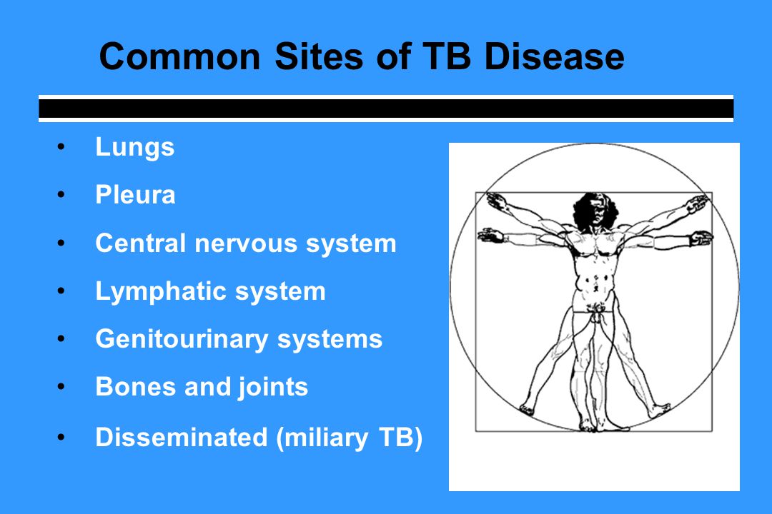 Common Sites of TB Disease