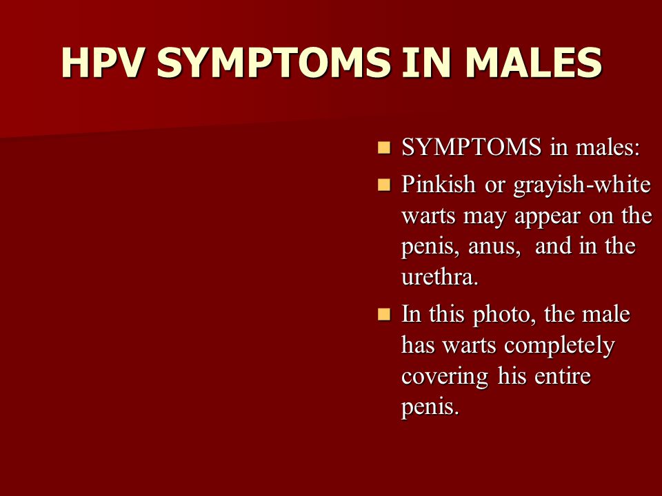 Hpv and cancer in males Hpv virus symptoms in males, Papillomavirus male