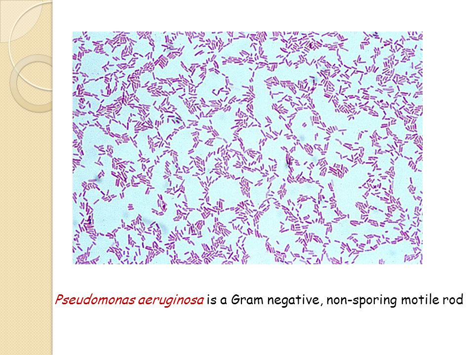 Pseudomonas - Microscopic appearance - Cultural characteristics - ppt video  online download