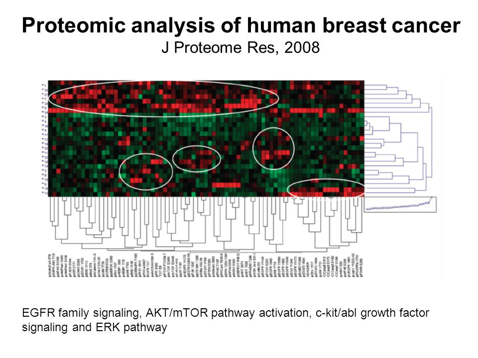Proteomic analysis of human breast cancer J Proteome Res, 2008