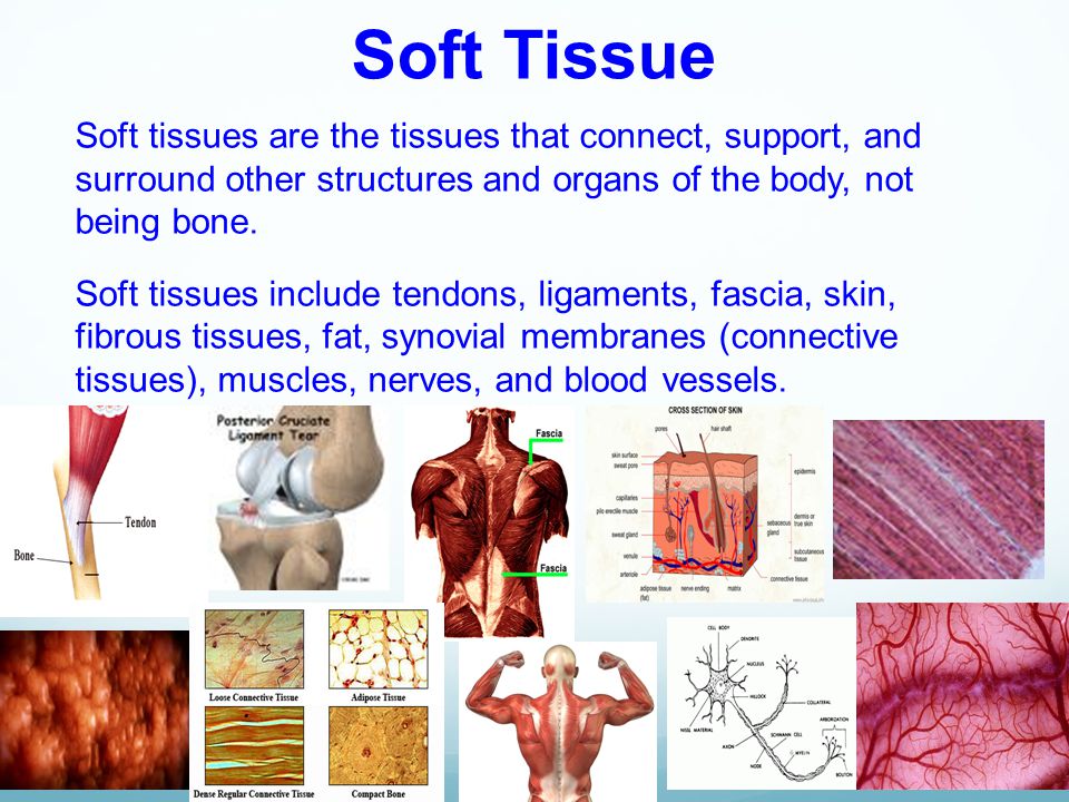 Soft tissue & Trauma Obj: I will describe various types of soft tissues in  the body Obj: I will explain how tissues respond to trauma Obj: I will  describe. - ppt video