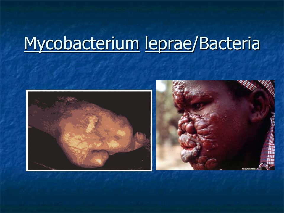 Mycobacterium leprae/Bacteria