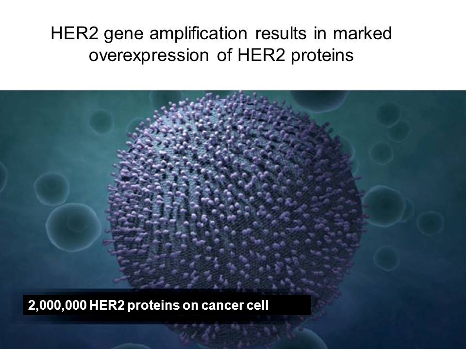 HER2 gene amplification results in marked overexpression of HER2 proteins