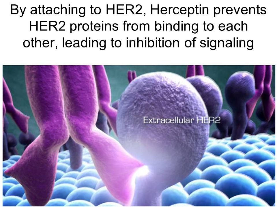 By attaching to HER2, Herceptin prevents HER2 proteins from binding to each other, leading to inhibition of signaling