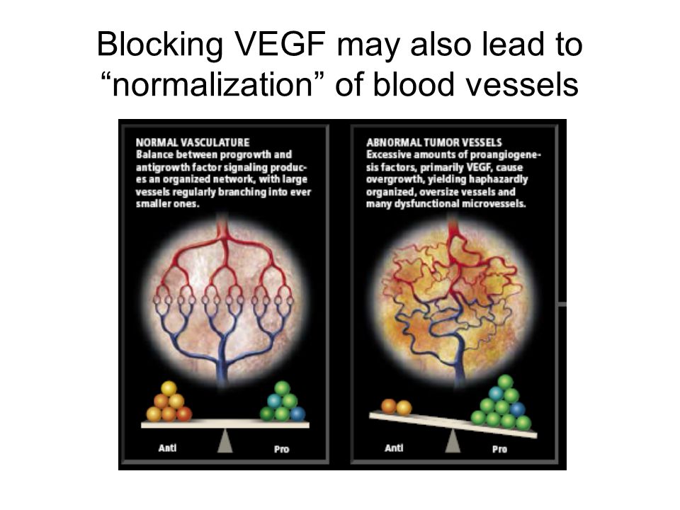 Blocking VEGF may also lead to normalization of blood vessels