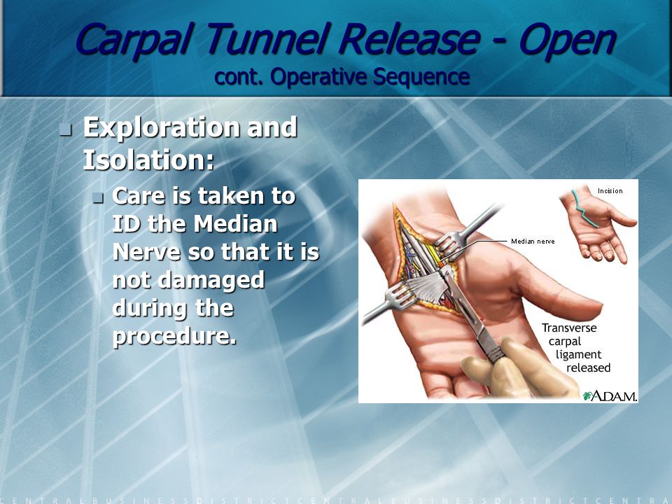 Carpal Tunnel Release - Open cont. 