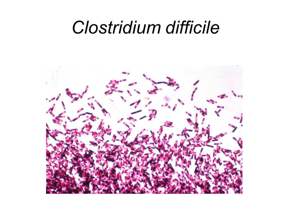 Клостридиум диффициле. Clostridium difficile микробиология. Бактериофаг клостридии.