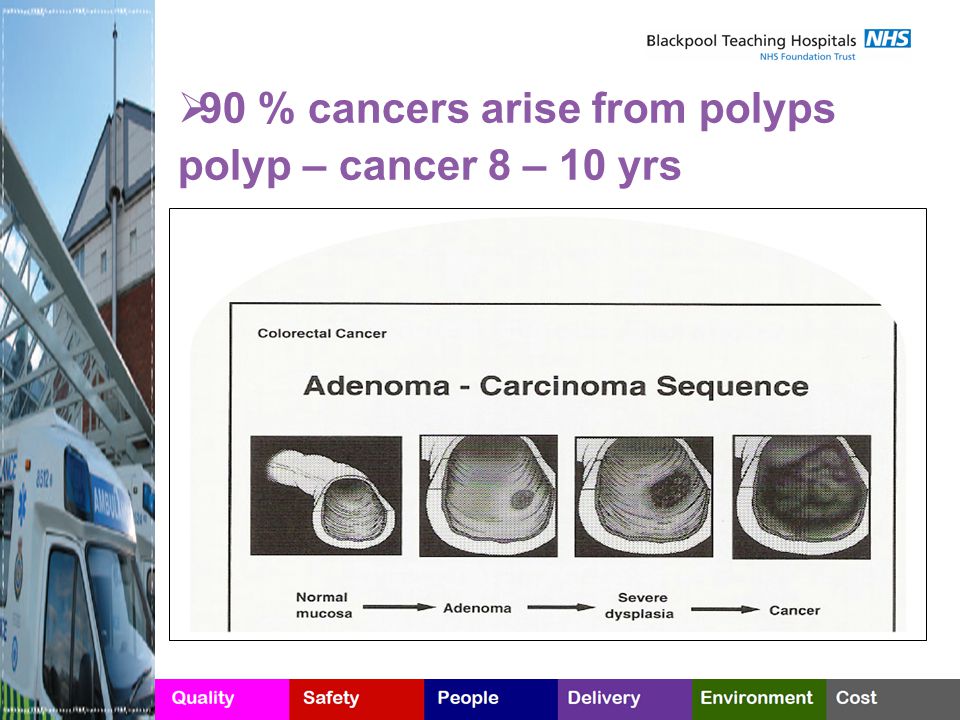 90 % cancers arise from polyps polyp – cancer 8 – 10 yrs
