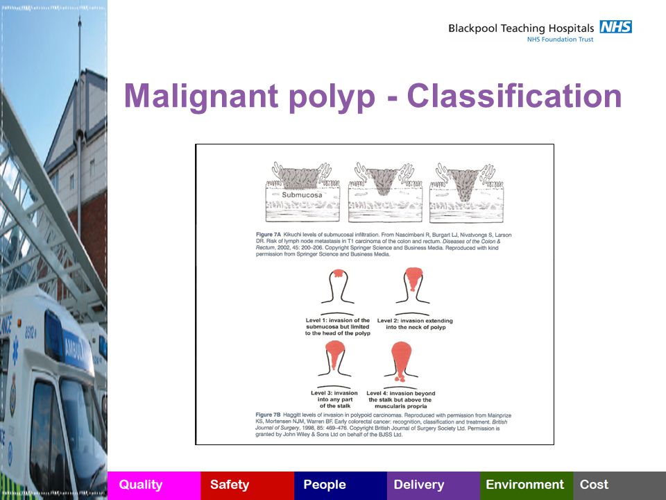 Malignant polyp - Classification