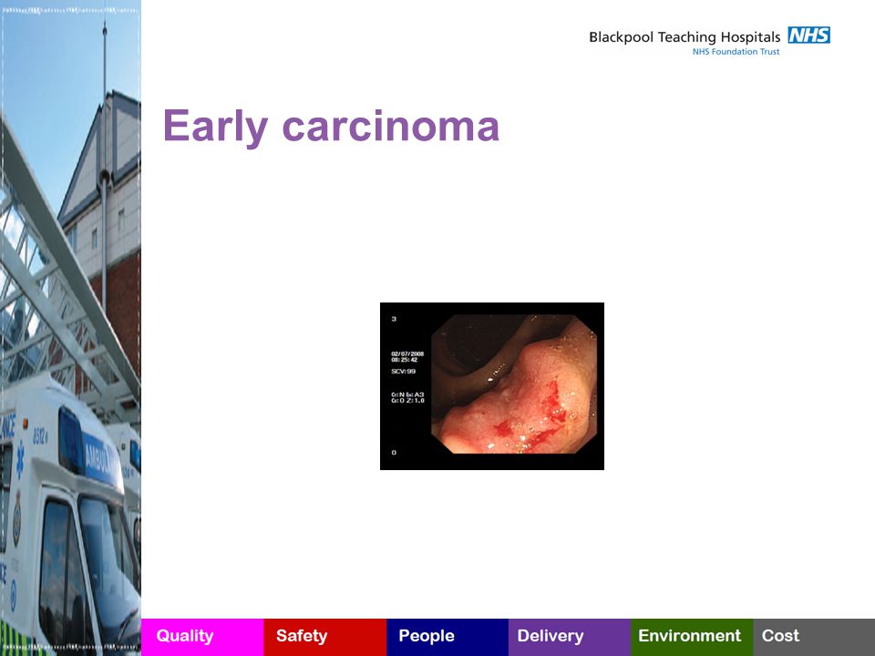 Early carcinoma