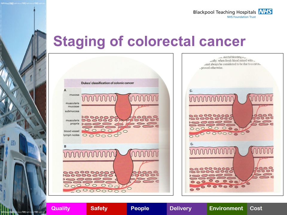 Staging of colorectal cancer