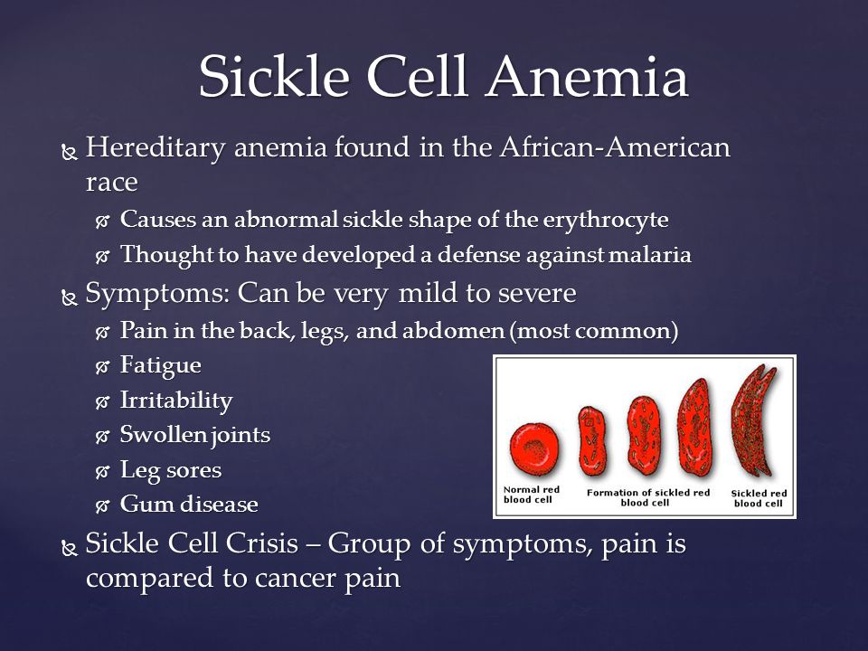 Sickle Cell Anemia Hereditary anemia found in the African-American race. 