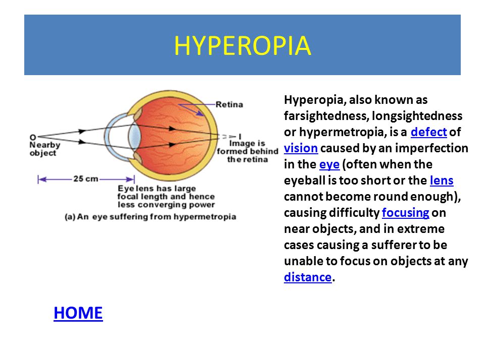 hyperopia myopia senilis)