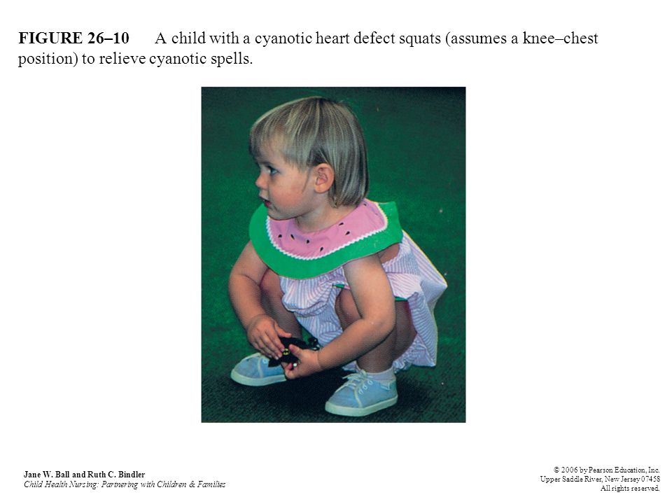 Nursing Care Of The Child With A Cardiovascular Disease Ppt Download