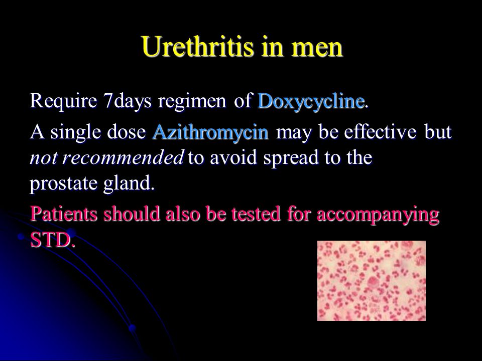 antibiotikumok a prostatitis urethritis kezelésében