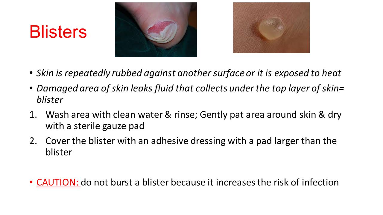 Wounds and Circulation ppt video online download