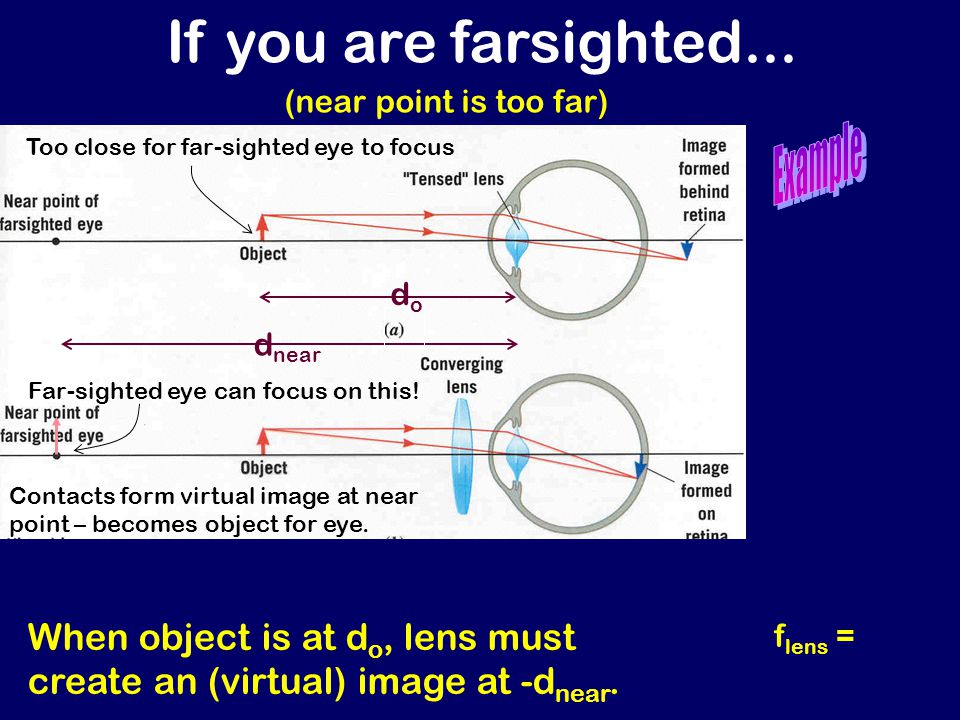 Physics 1161 Lecture 19 Lenses And Your Eye Ppt Video Online Download