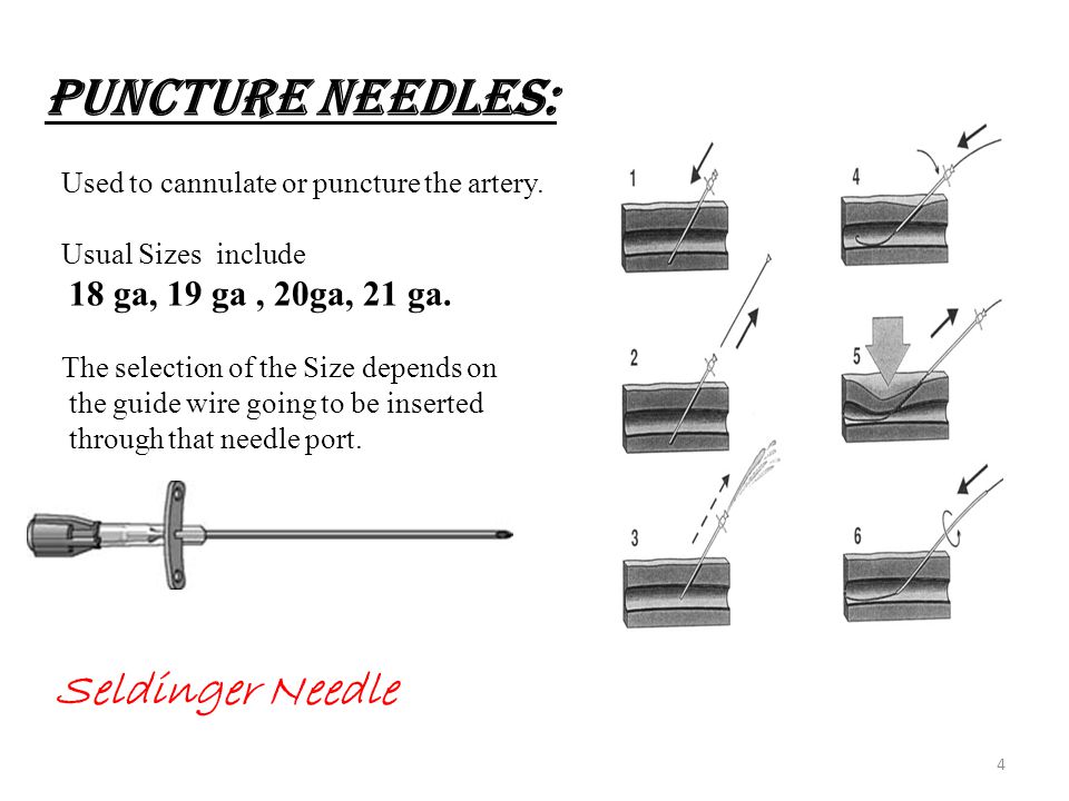 PUNCTURE NEEDLES: Seldinger Needle