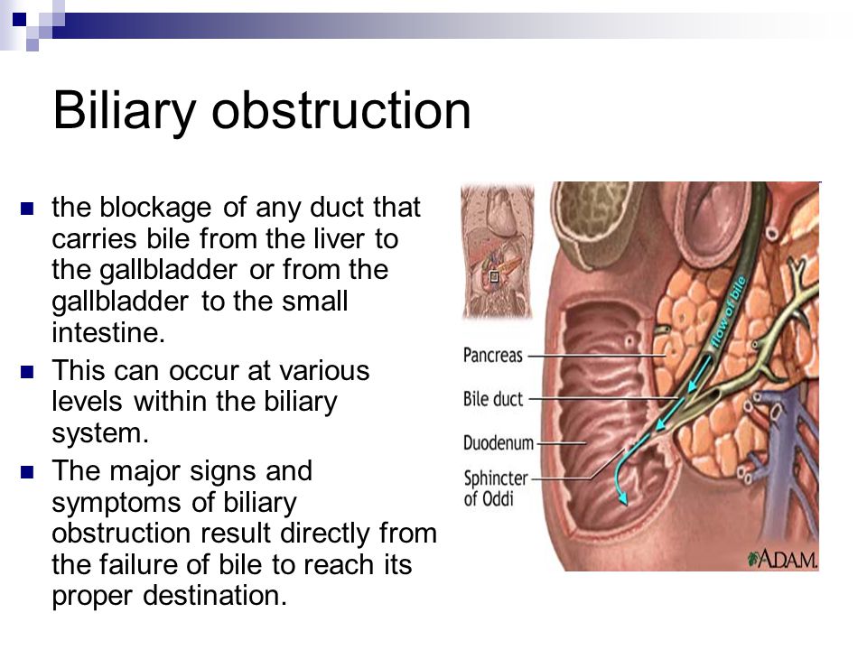 Diseases Of The Gall Bladder And Extrahepatic Bile Ducts Ppt Video Online Download