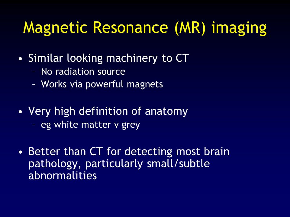 Neurology Dr Chris Derry Consultant Neurologist - ppt download