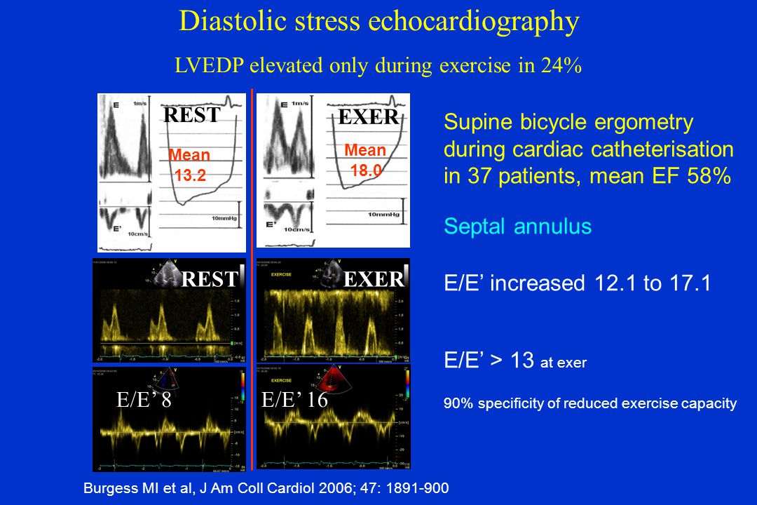 THE ECHOCARDIOGRAPHIC EVALUATION OF THE HEART FAILURE PATIENT - ppt video  online download