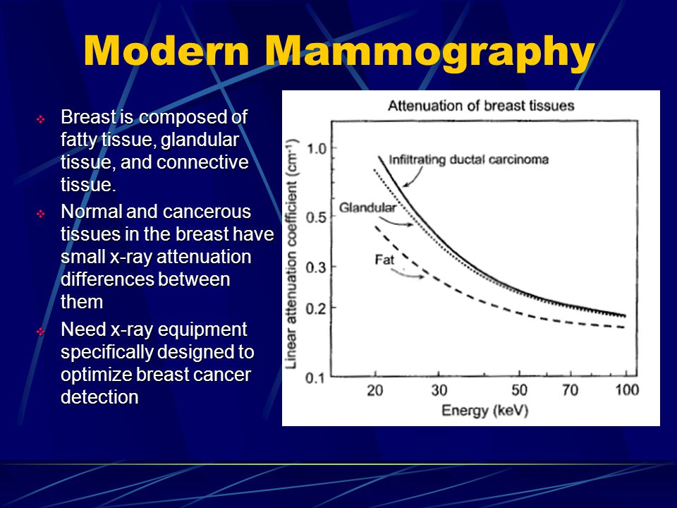 Modern Mammography Breast is composed of fatty tissue, glandular tissue, and connective tissue.