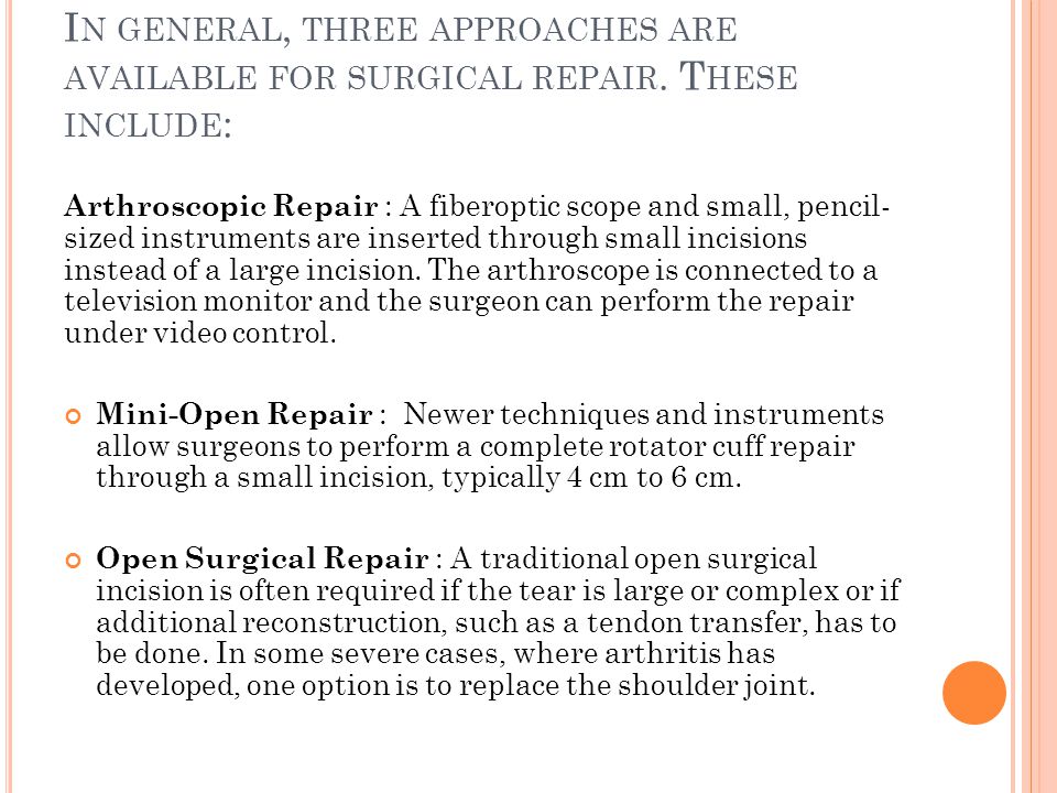 In general, three approaches are available for surgical repair