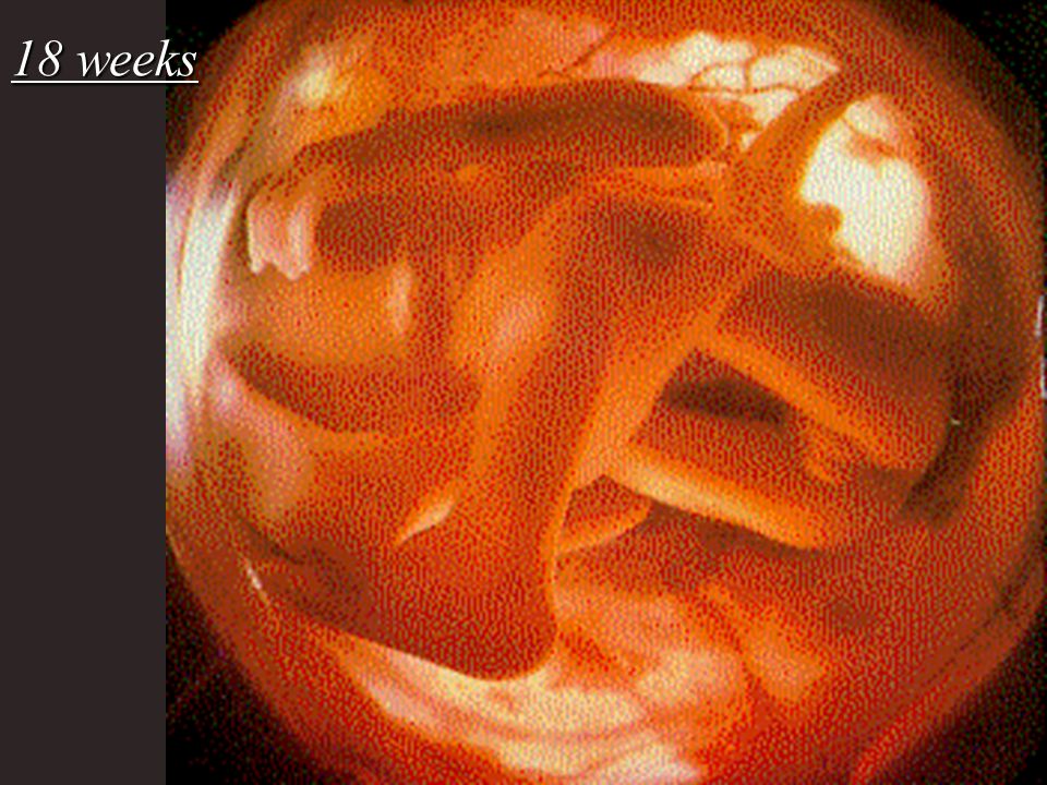 Фото 17 18 недель беременности фото