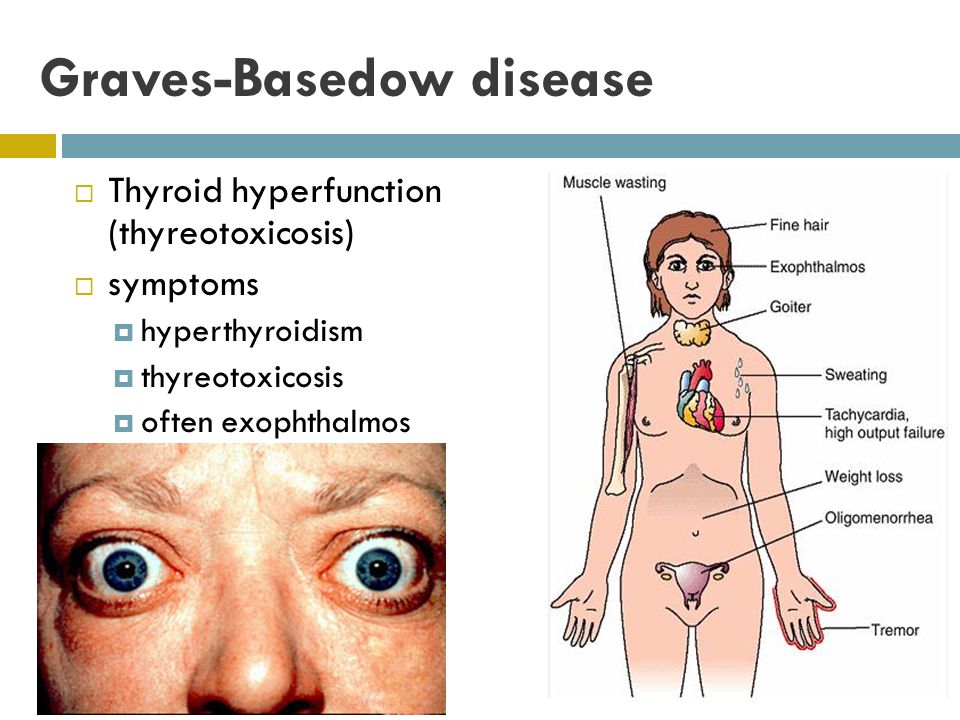 Graves-Basedow disease.