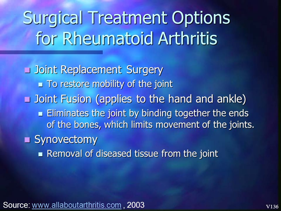Surgical Treatment Options for Rheumatoid Arthritis