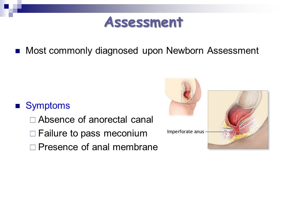 Assessment Most commonly diagnosed upon Newborn Assessment Symptoms