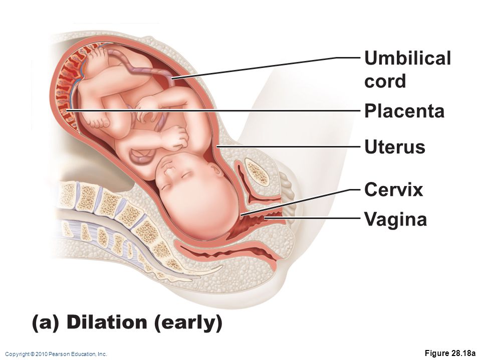 Umbilical cord Placenta Uterus Cervix Vagina (a) Dilation (early) .