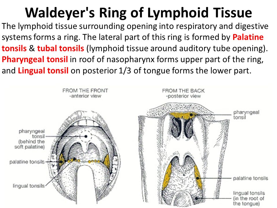 PDF) Waldeyer ring lymphomas. A clinicopathological study of 79 cases |  Manuel morente - Academia.edu