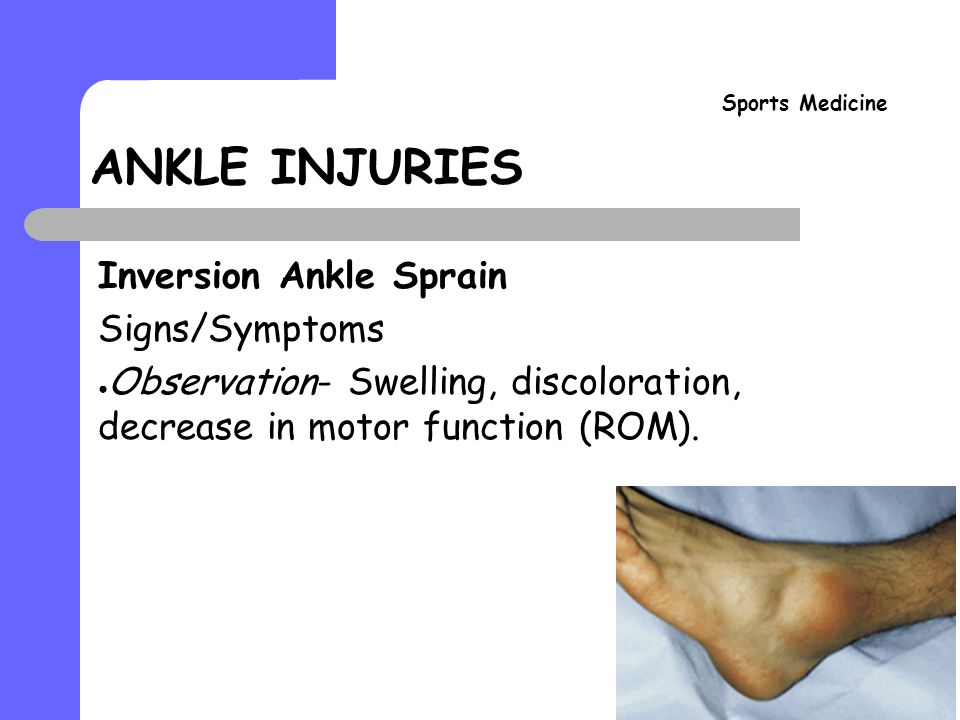 ANKLE INJURIES Sports Medicine Ankle Sprain Evaluation. - ppt video online  download