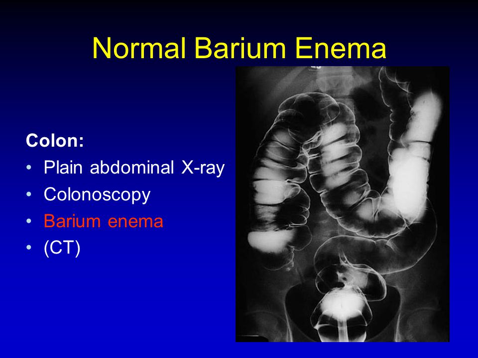 Normal Barium Enema Colon: Plain abdominal X-ray Colonoscopy
