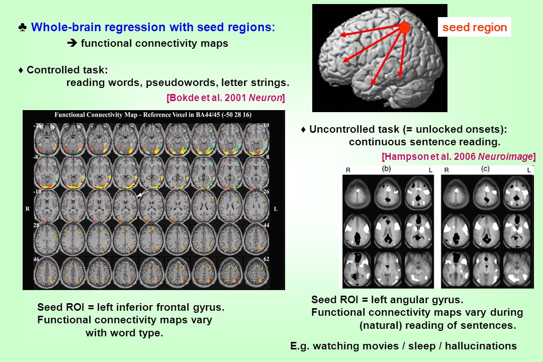 Dcm Dynamic Causal Modelling For Fmri Ppt Download