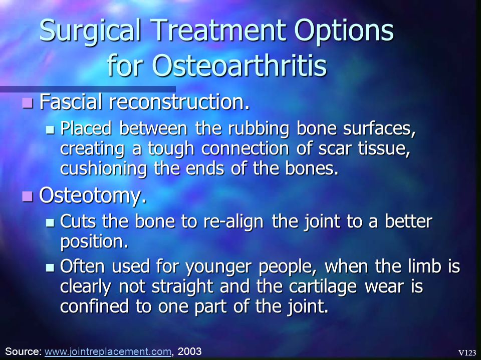Surgical Treatment Options for Osteoarthritis
