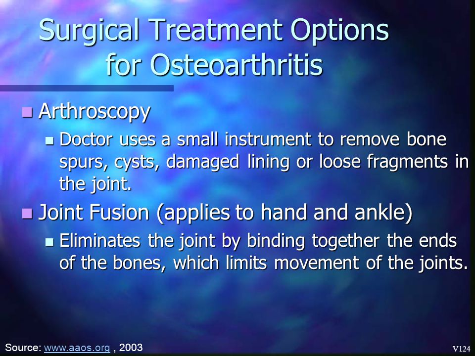 Surgical Treatment Options for Osteoarthritis