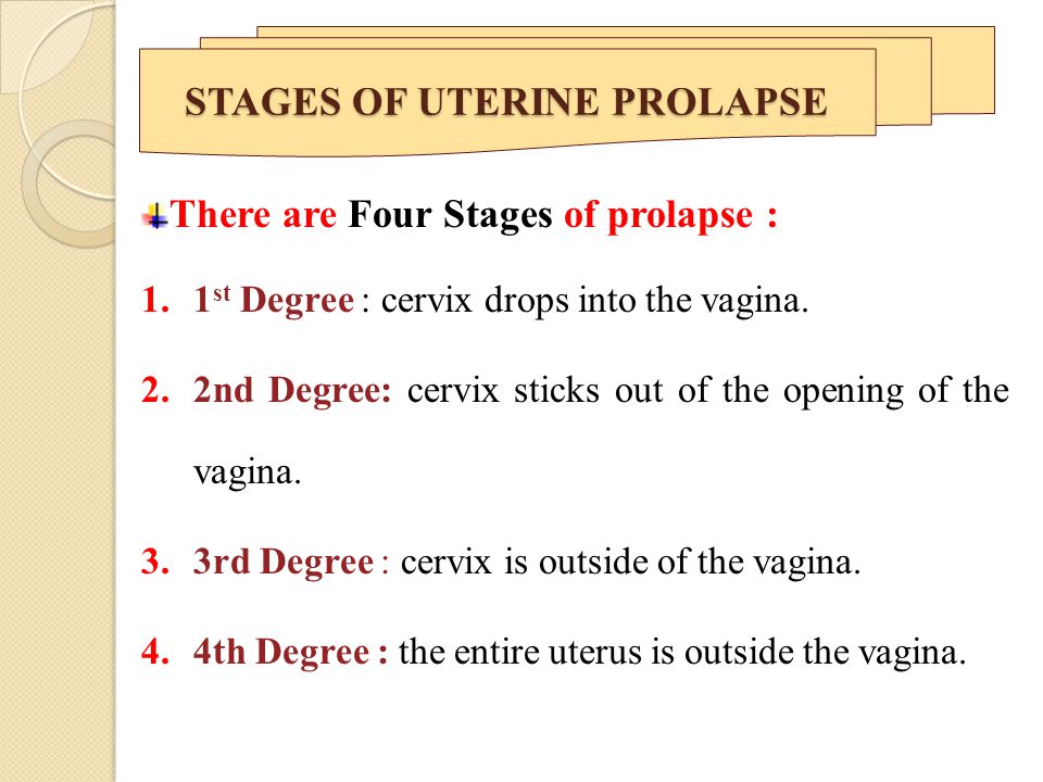 STAGES OF UTERINE PROLAPSE