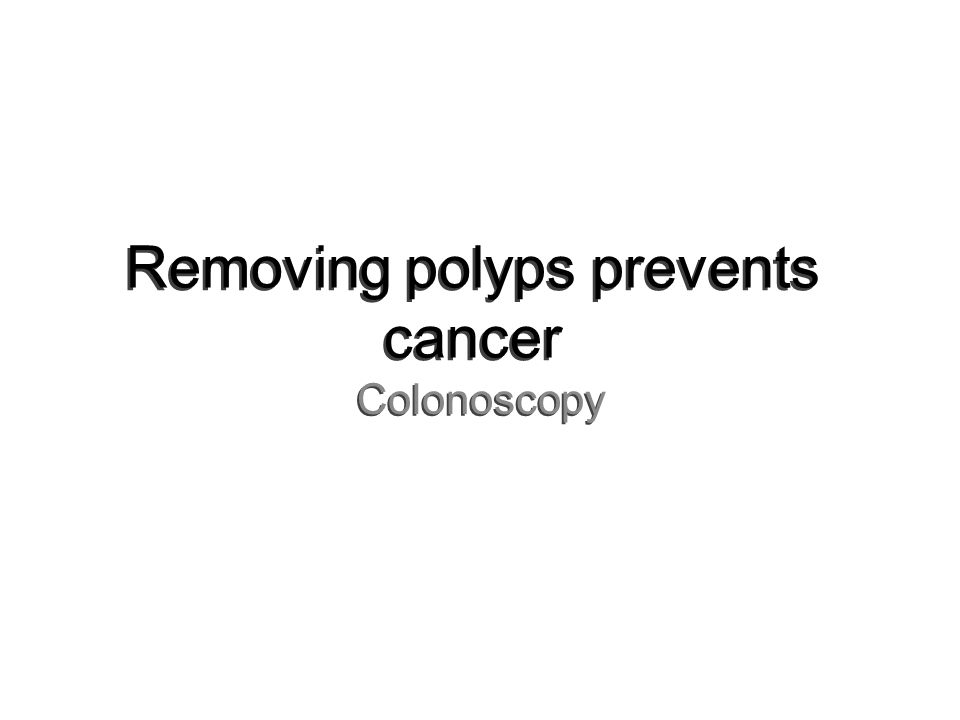 Removing polyps prevents cancer