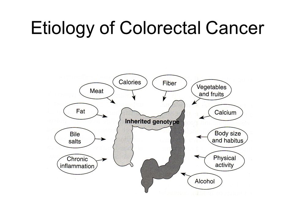 Etiology of Colorectal Cancer