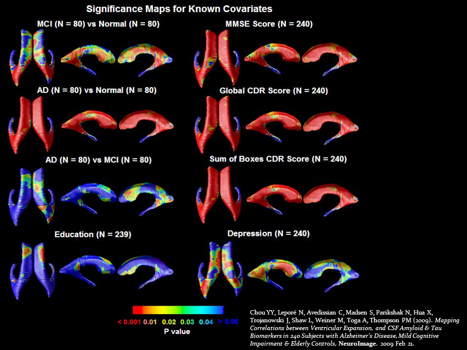 Brain Changes In 676 Adni Subjects Summary Of 10 Studies Using Tensor Based Morphometry Automated Hippocampal Maps Paul Thompson And The Ucla Adni Ppt Video Online Download