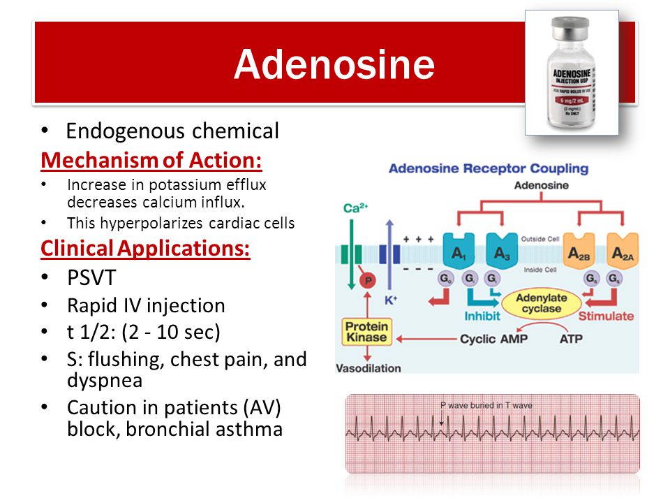 Anti Arrhythmic Drugs Marwa A Khairy Md Ppt Download