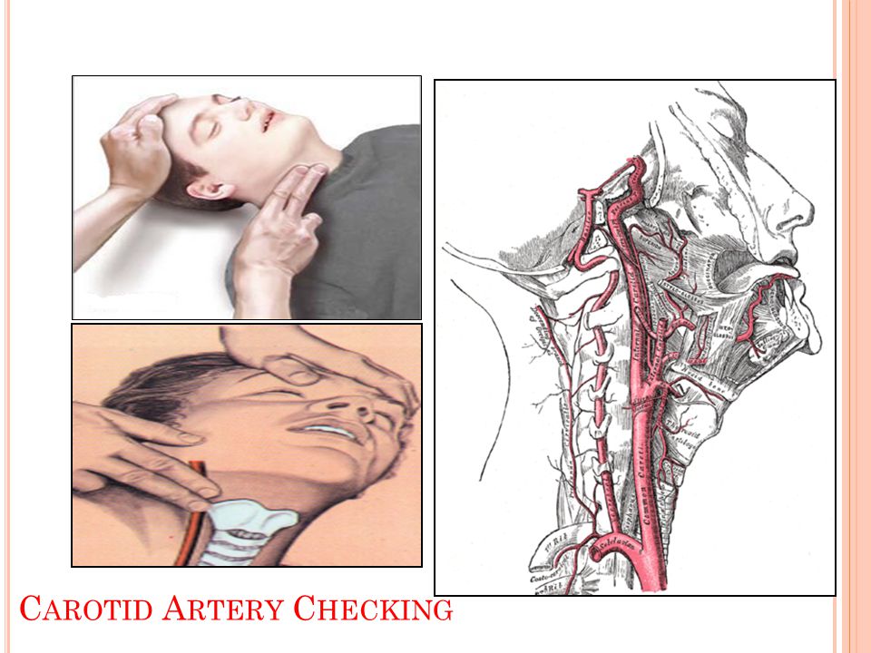 Carotid Artery Checking