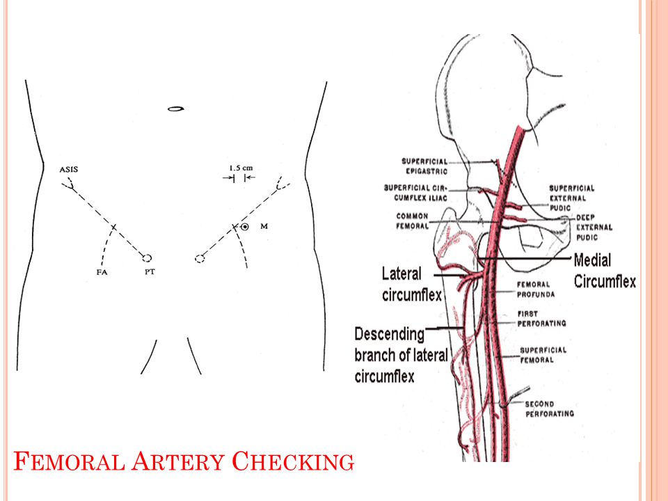 Femoral Artery Checking