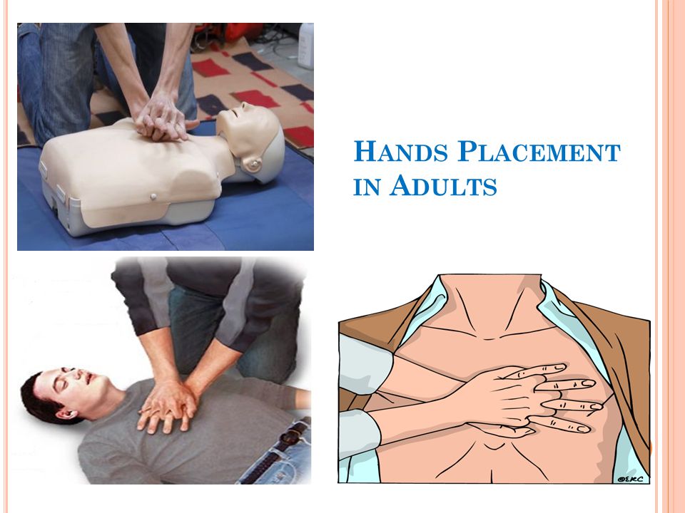 Hands Placement in Adults